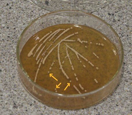 Plate w colonies.jpg